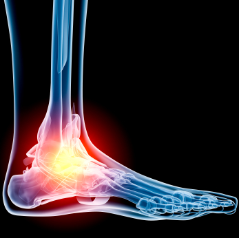 Ankle Arthroscopy Treating Ankle Injuries With Keyhole Surgery