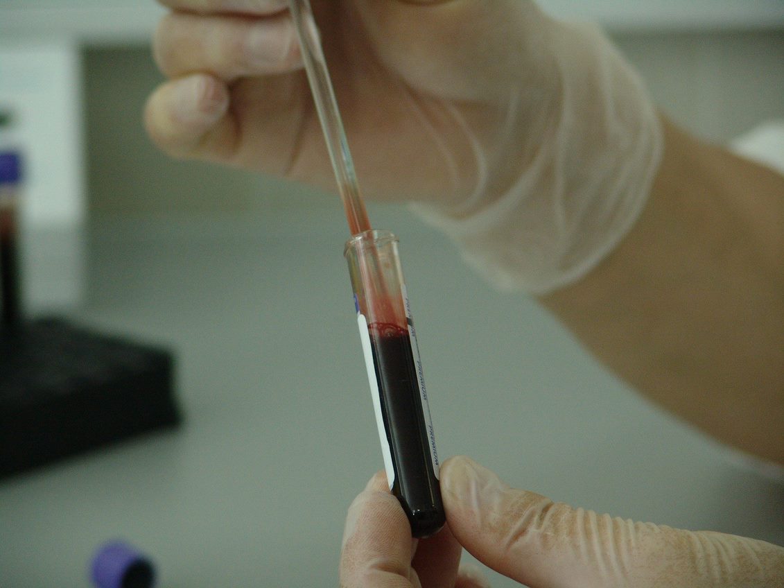 Testing for blood cancers