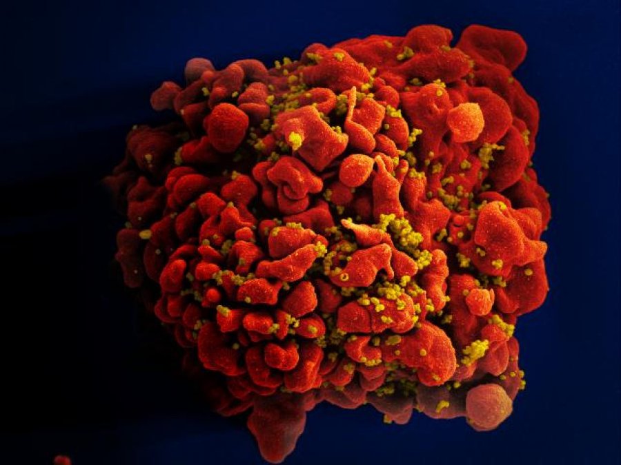 HIV-infected-H9-T-Cell