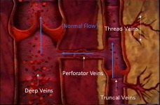 Vein perforators