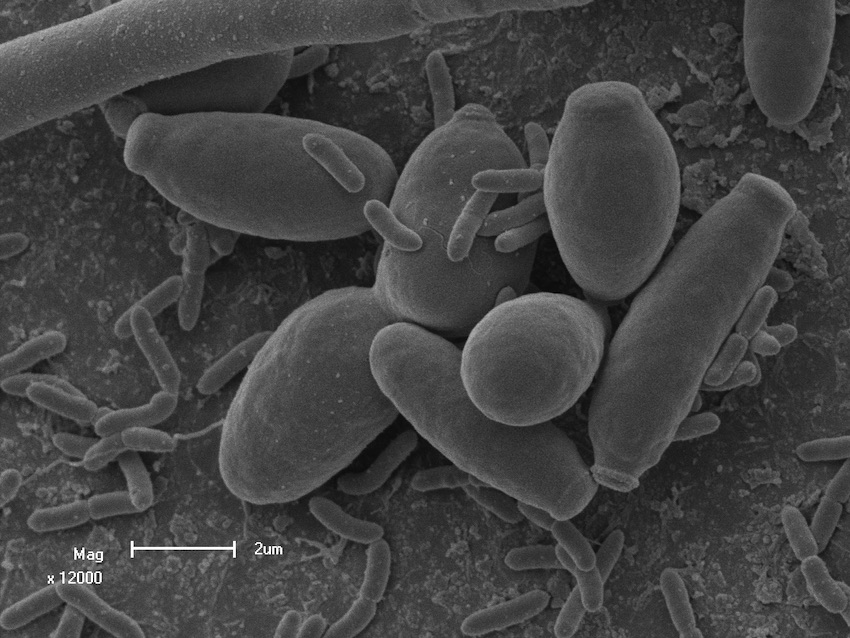 EM of Candida and Pseudomonas aeroginosa