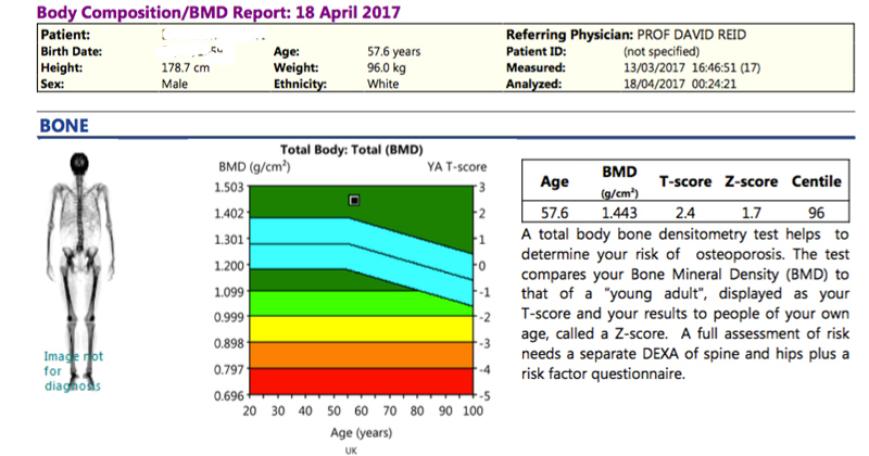 body composition scan