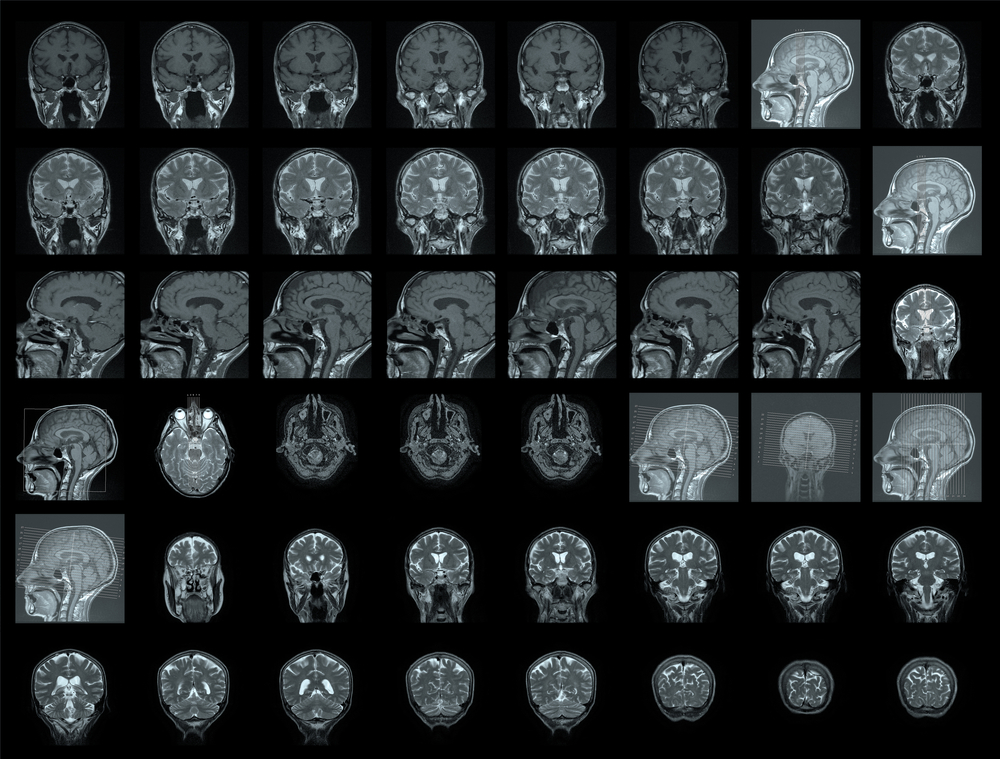 Brain scans