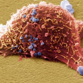 Cancer methylscape