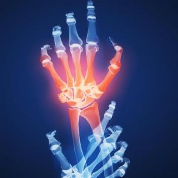 Detecting early arthritis