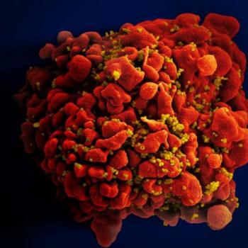 HIV-infected-H9-T-Cell.jpg