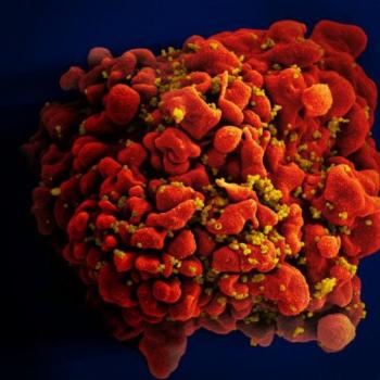 HIV-infected-H9-T-Cell.jpg
