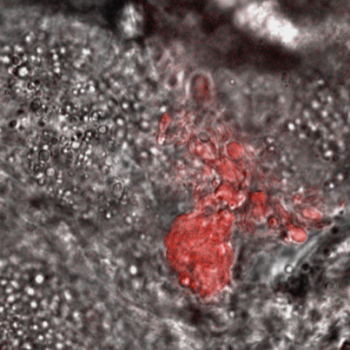 Microsporidia MB in anopheles ovaries