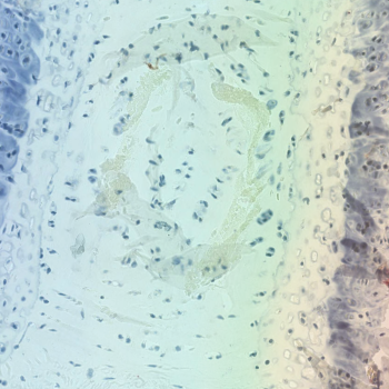 Tracking immune cells