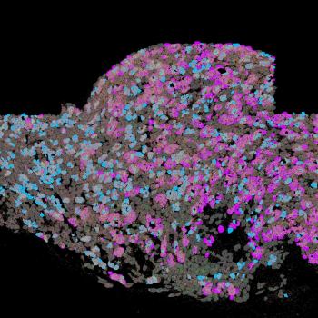 Ganglia in sleep disturbance