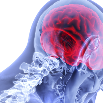 Diagnosing meningiomas